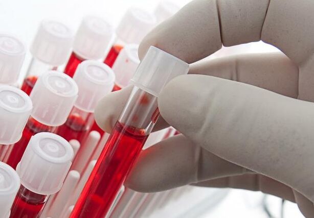 krvný test po požití alkoholu